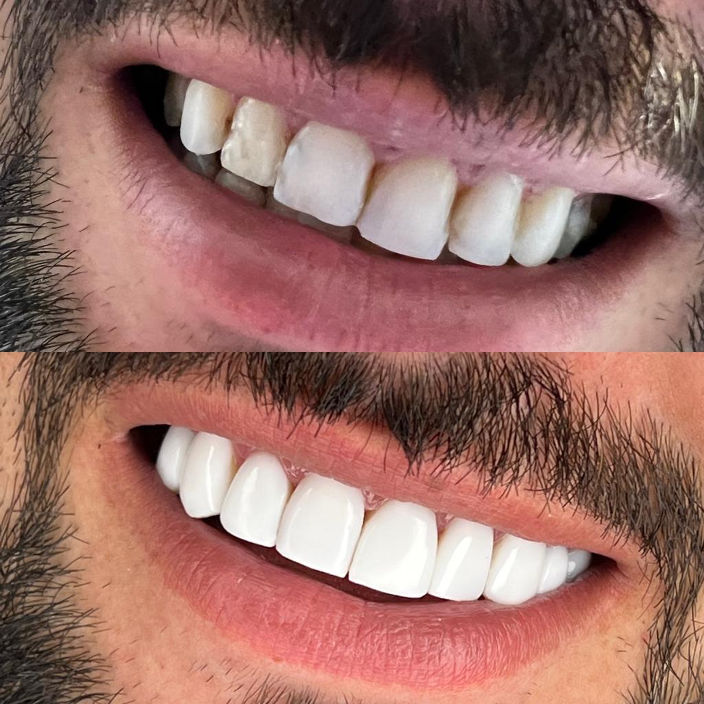 دندانپزشک زیبایی الهیه